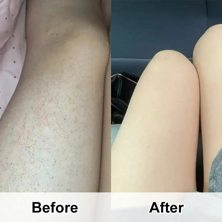 بخاخ ديفي فيت لتقشير الجسم بالكيراتين — السرّ الجديد لبشرة ناعمة، نظيفة وجذابة!