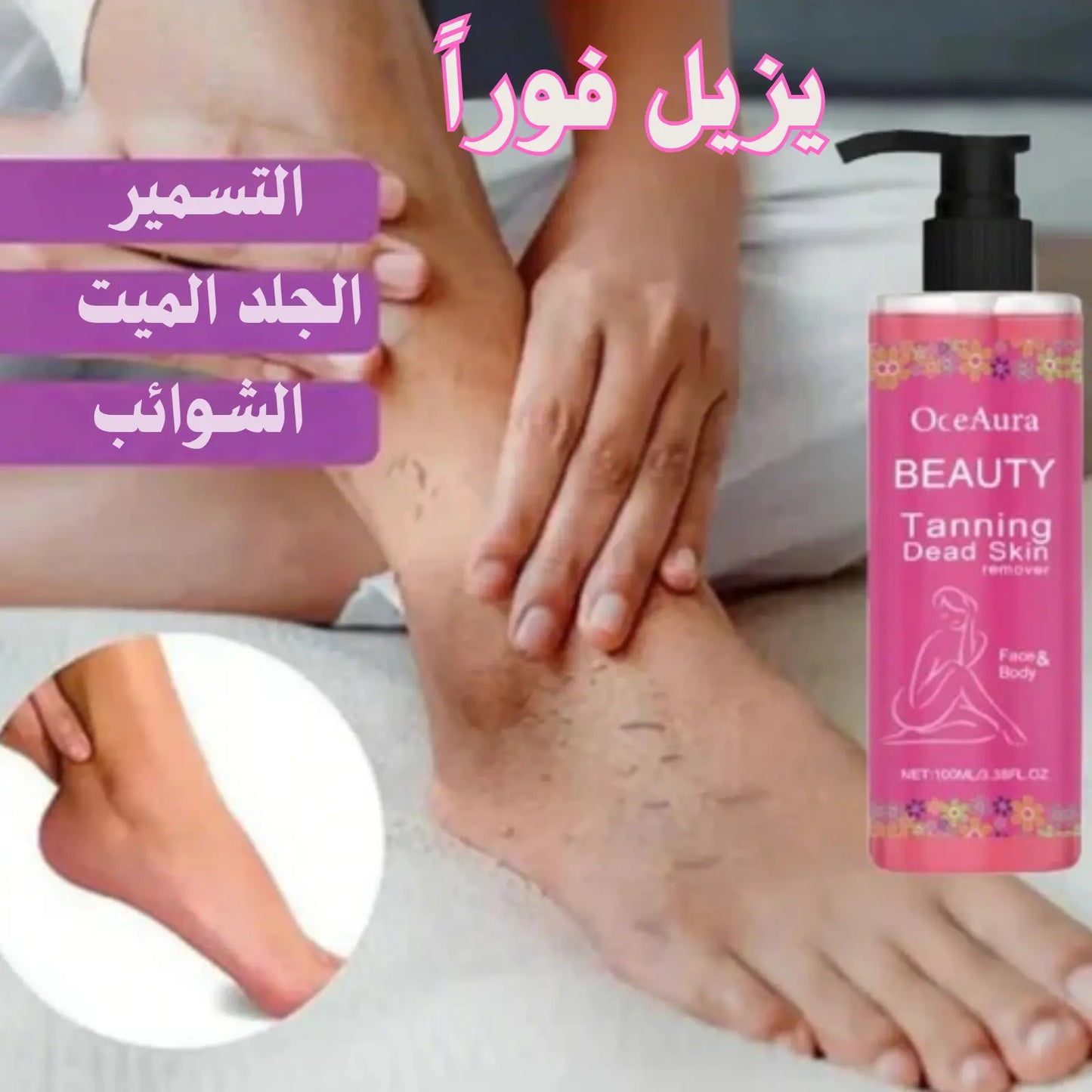 ✨ ودّعي الاسمرار والجلد الميت… واكشفي سر البشرة الناعمة والمشرقة! ✨
