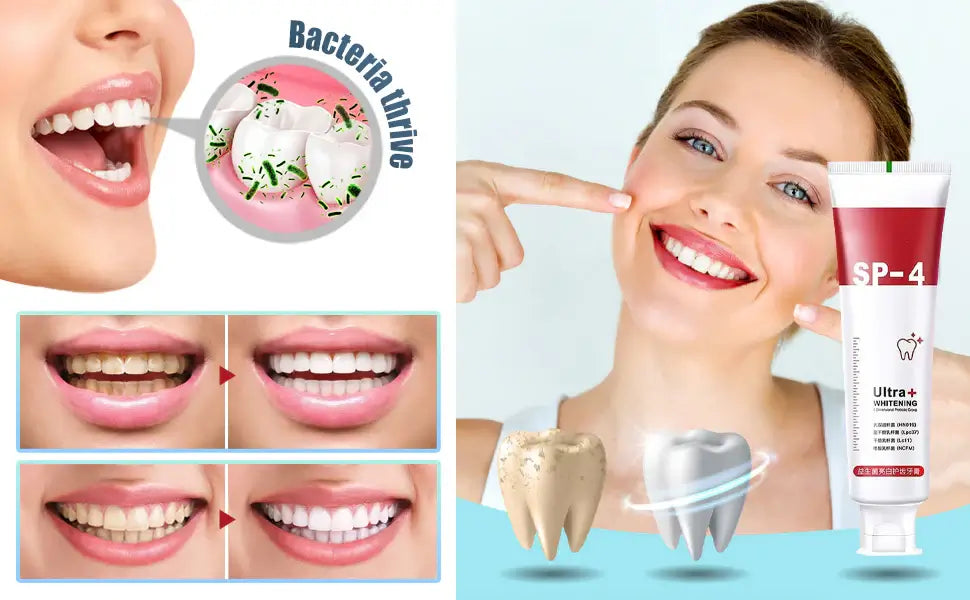 SP-4 – معجون البروبيوتيك الفاخر لتبييض الأسنان واسترجاع ثقتك بابتسامتك
